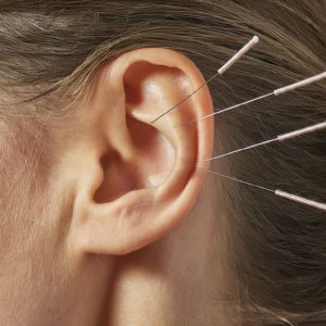 Auricular-Acupuncture-for-a-Healthy-Liver