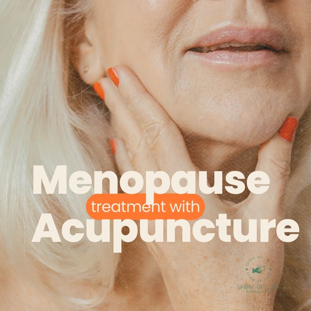 Menopause Acupuncture